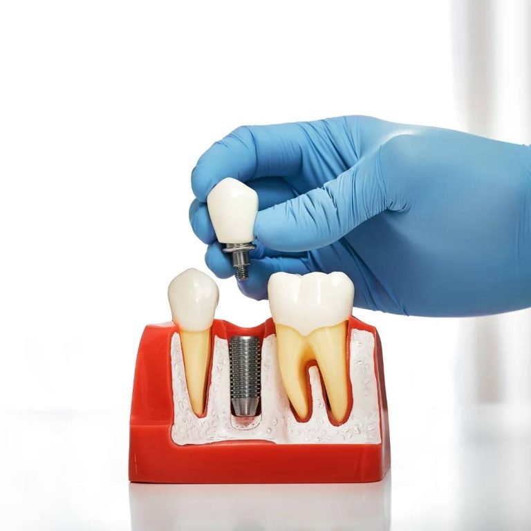 Oral Surgery in Tilbury