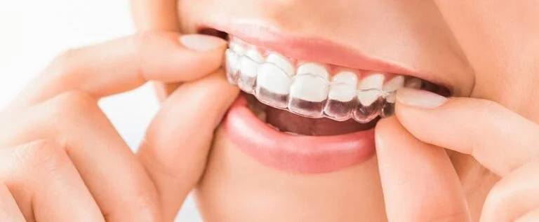 Invisalign in Tilbury, ON