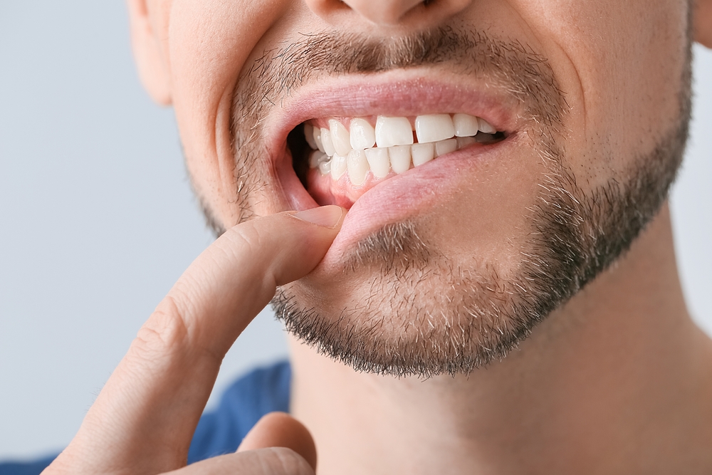 Gum Disease Treatment in Tilbury